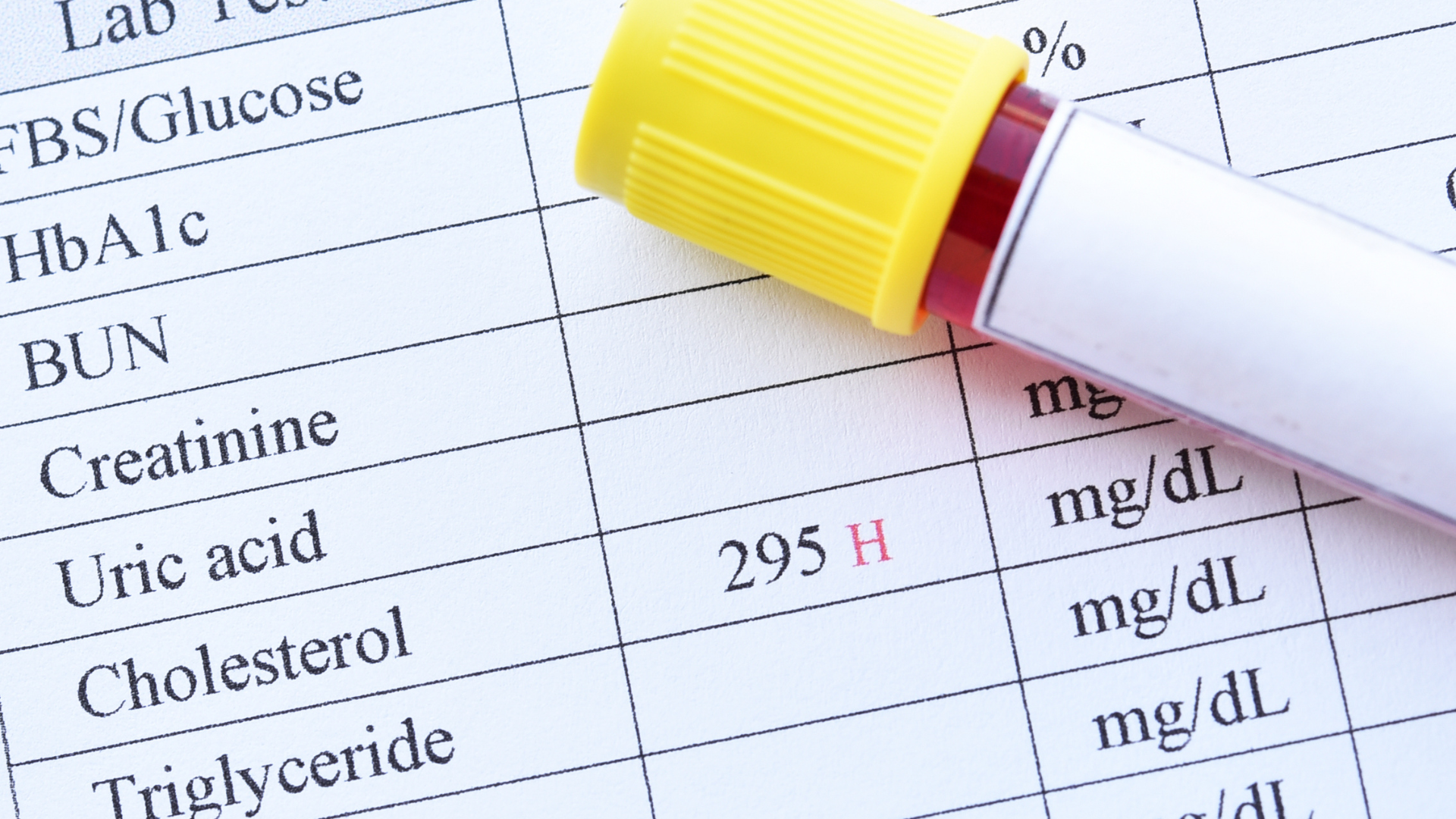 De ce nu este suficient să ai doar rezultatele